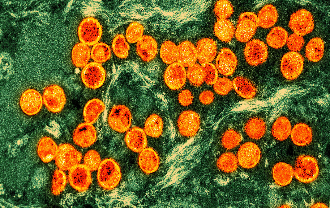 Monkeypox – what do we know?